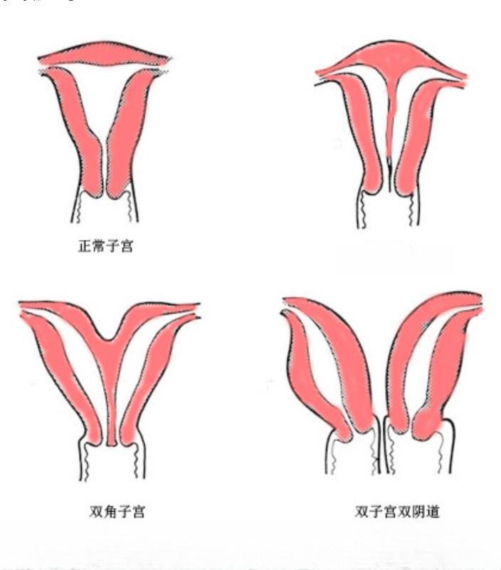 嘉定双阴道舒玉姐 图 4